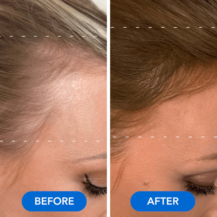 VOURGANIC® Hair Growth Ampoule
