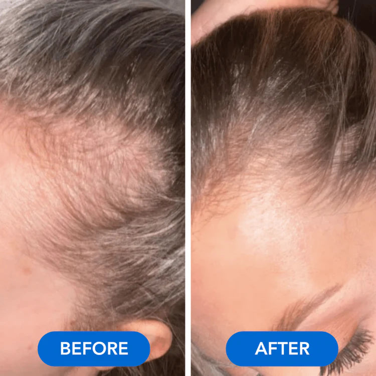 VOURGANIC® Hair Growth Ampoule