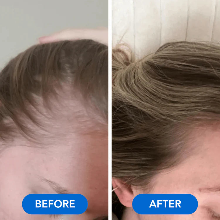 VOURGANIC® Hair Growth Ampoule