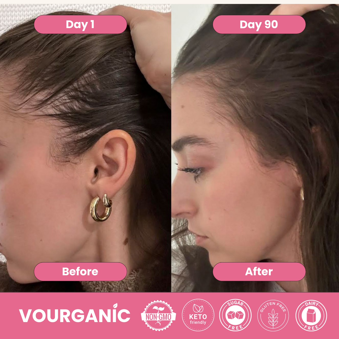 VOURGANIC® Hair & Beauty Gummies