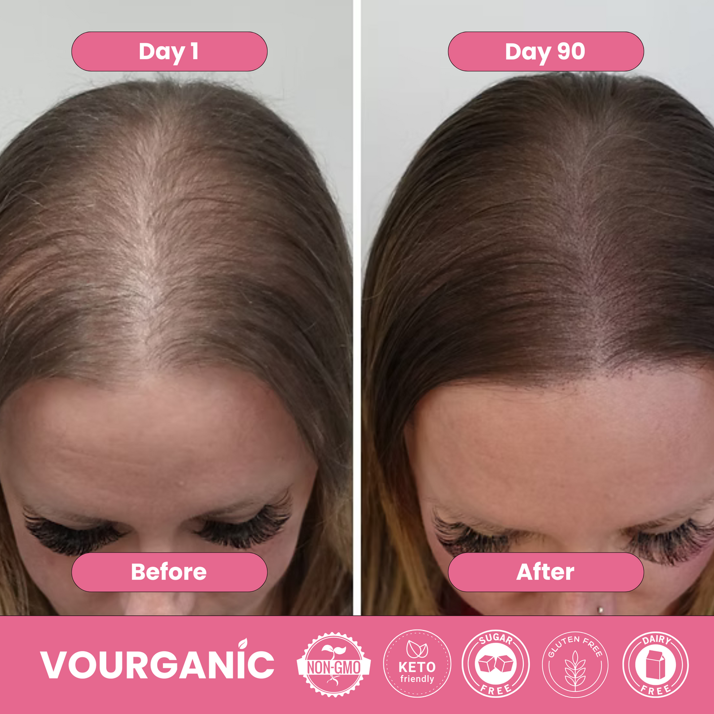 VOURGANIC® Hair & Beauty Gummies