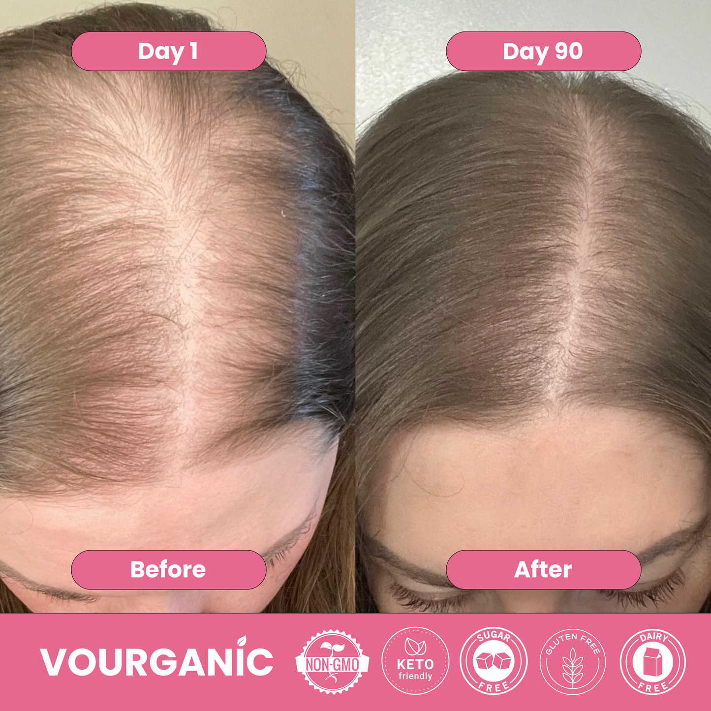 VOURGANIC® Hair & Beauty Gummies